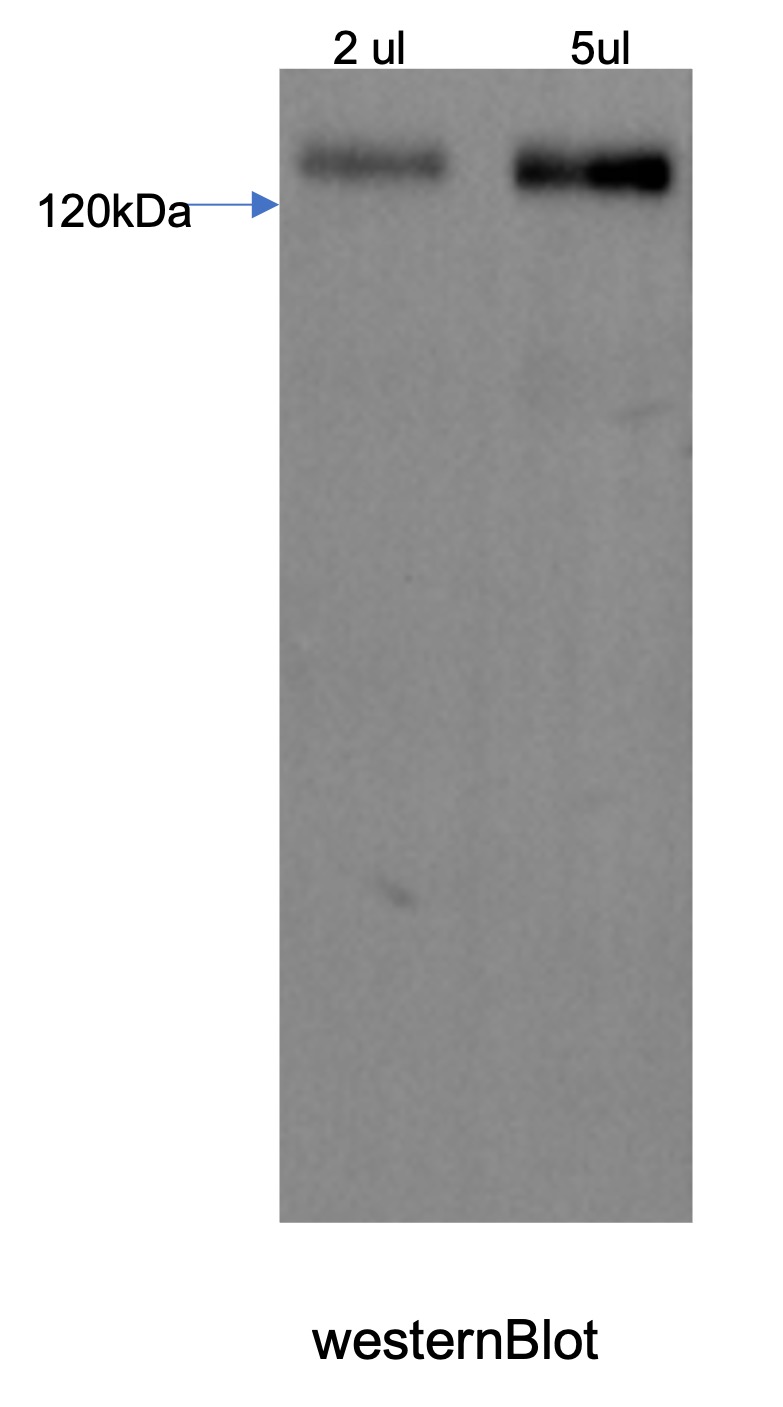 Recombinant Human Brevican Core Protein/BCAN/BEHAB (C-6His)